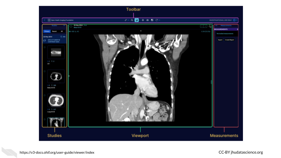 The OHIF Graphical User Interface has an image viewer (center) which  includes a tool bar (above center) to modify, view, and annotate images. A menu on the left allows users to access images related to the current patient in other studies, and a menu on the right is used for making measurements and exporting measurement reports.
