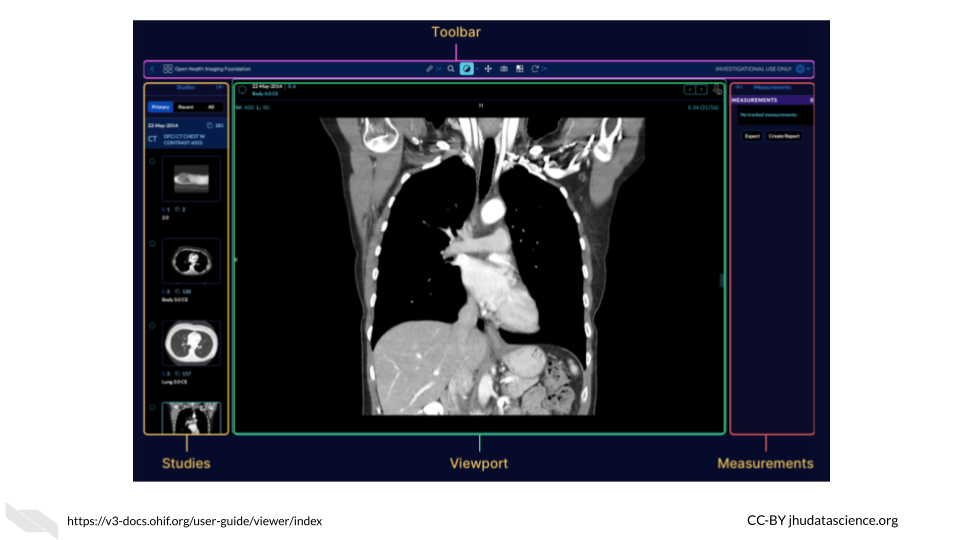 The OHIF image viewer (center) includes a tool bar for to modify the viewing and annotation of images (above center), a menu on the left to access images related to the current patient in other studies, and a menu on the right for making measurements and exporting measurement reports.